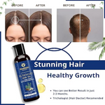 Thumbnail for Moolveda 100% Pure Rosemary Hair Oil for Hair Growth - Distacart