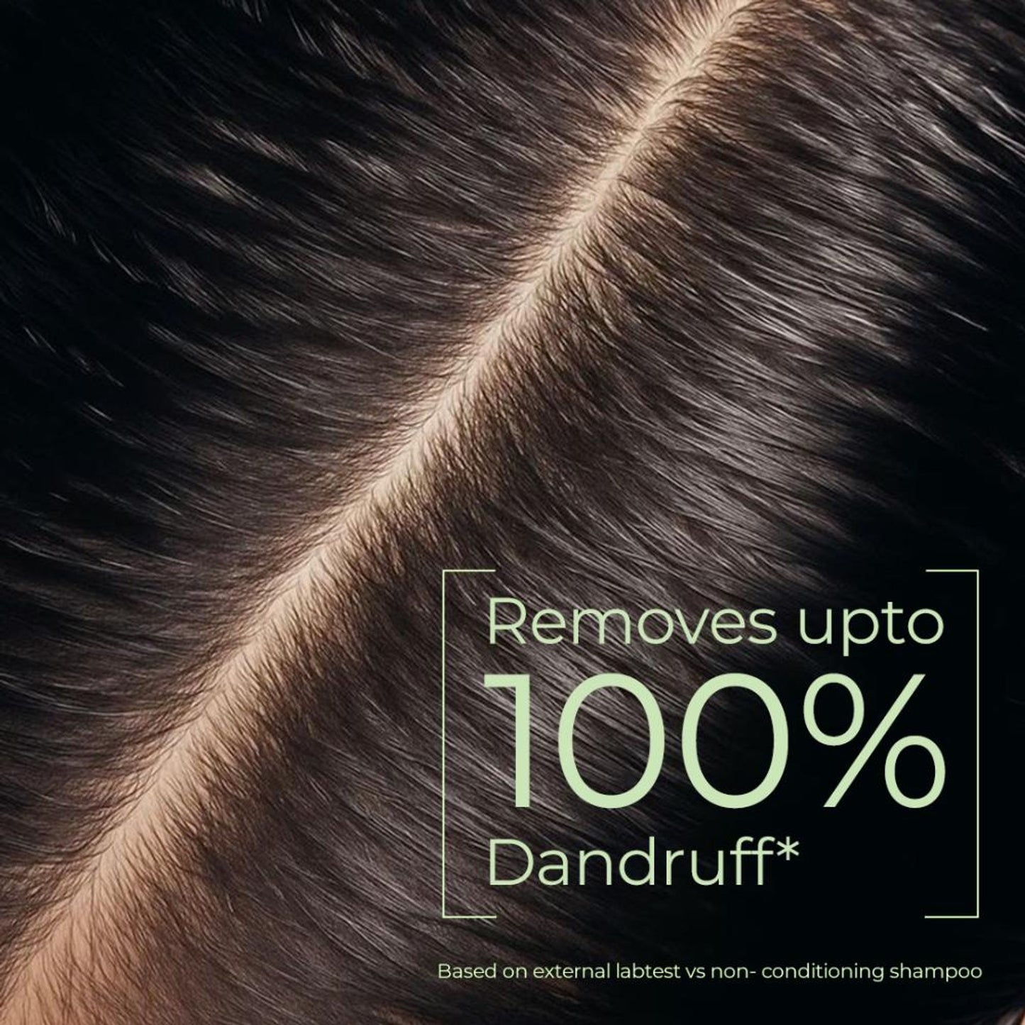 Naturali Dandruff Defence Shampoo With Cactus Extract, Tea Tree Oil & Climbazole - Distacart