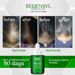 Thumbnail for Lakshmi Krishna Naturals Redensyl Advanced Hair Growth Serum