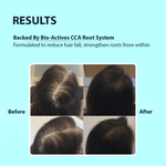 Thumbnail for Dermistry Caffeine Collagen Wheat Protein Anti-Hair Fall Control Shampoo - Distacart