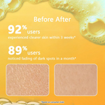 Thumbnail for Milky Moon Vitamin C Face Wash for Brightening Face Cleanser - Dista