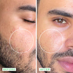 Thumbnail for Farmacy Beauty Deep Sweep 2% BHA Pore Cleaning Toner With Salicylic Acid & Moringa Water