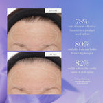 Thumbnail for Kora Organics Plant Stem Cell Retinol Alternative Serum - Dista