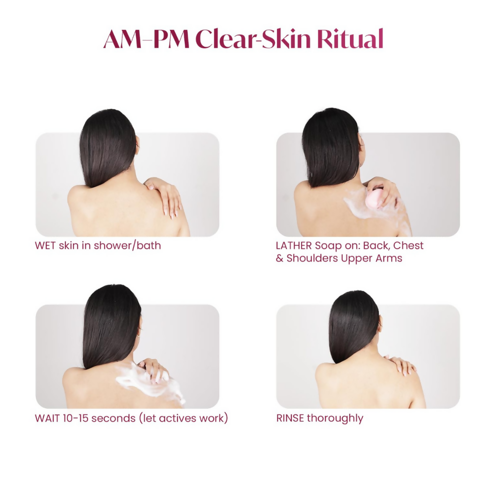 Alite Anti-Acne Soap - Distacart