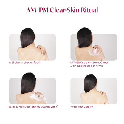 Alite Anti-Acne Soap - Distacart