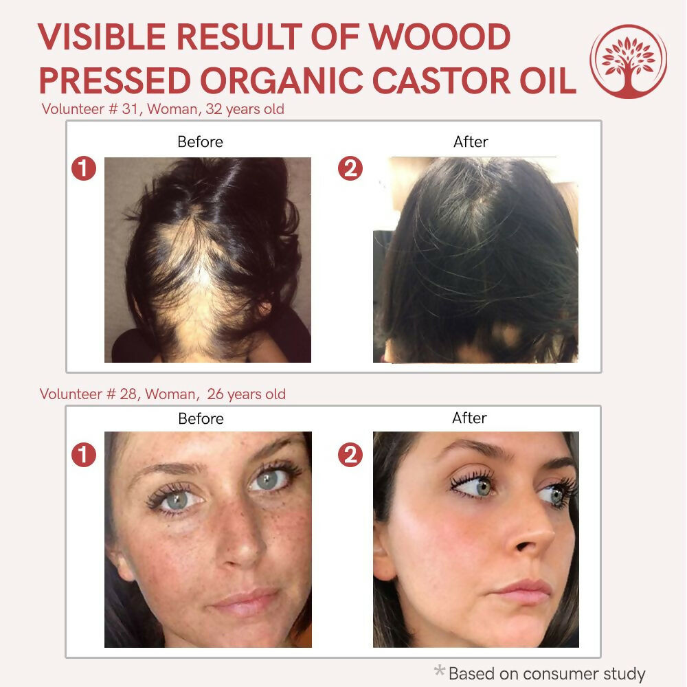 Ivory Natural Wood Pressed Organic Castor Oil For Healthy Skin & Hair Wellness - Distacart