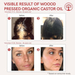 Thumbnail for Ivory Natural Wood Pressed Organic Castor Oil For Healthy Skin & Hair Wellness - Distacart