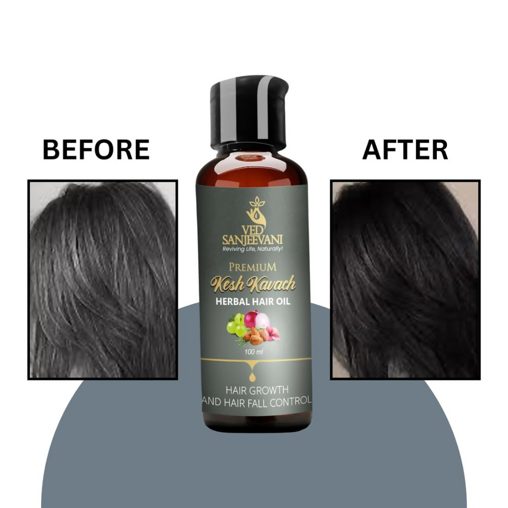Ved Sanjeevani Kesh Kavach Herbal Hair Oil - Dista