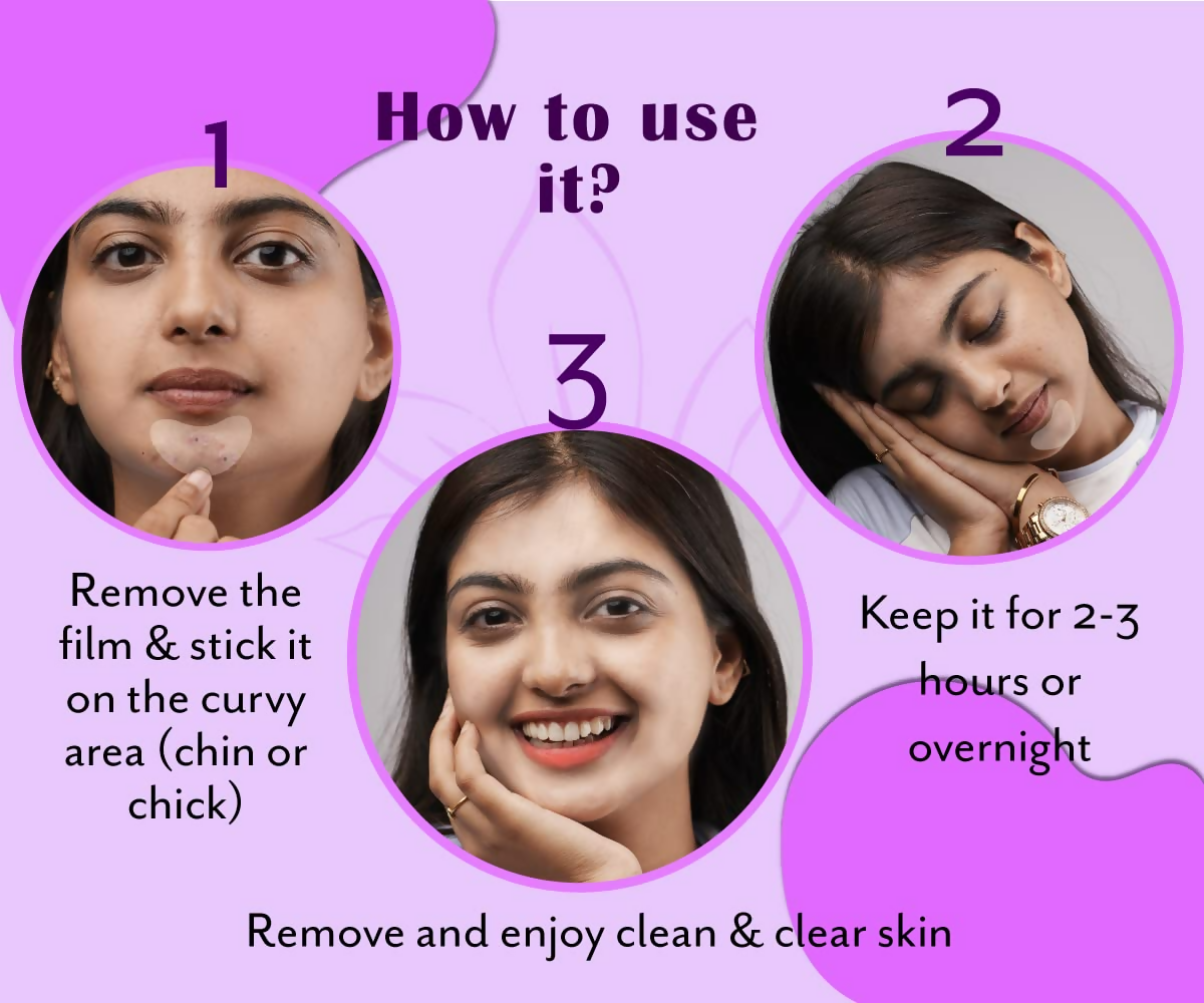 Urban Yog Acne Pimple Patch - Invisible Facial Stickers Cover With 100% Hydrocolloid