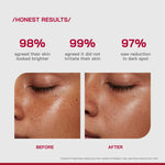 Thumbnail for Proven Honest Derma (PHD) 10% Vitamin C Brightening Serum - Distacart