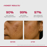 Thumbnail for Proven Honest Derma (PHD) 2% Alpha Arbutin Serum - Distacart
