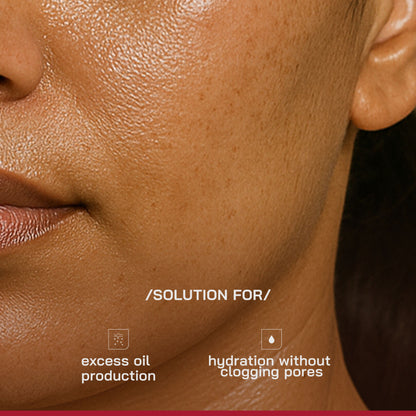Proven Honest Derma (PHD) 3% Niacinamide Oil-Free Moisturizer - Distacart