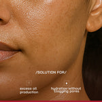 Thumbnail for Proven Honest Derma (PHD) 3% Niacinamide Oil-Free Moisturizer - Distacart