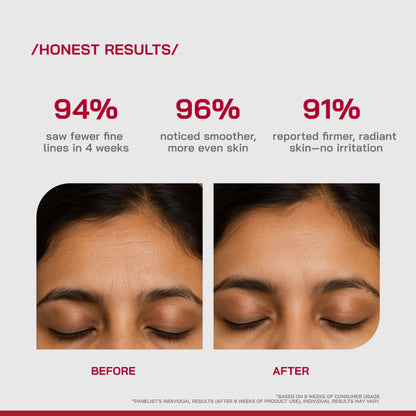 Proven Honest Derma (PHD) 0.3% Retinol Serum With Bakuchiol & Peptides - Distacart