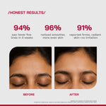 Thumbnail for Proven Honest Derma (PHD) 0.3% Retinol Serum With Bakuchiol & Peptides - Distacart