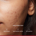 Thumbnail for Proven Honest Derma (PHD) 10% Niacinamide Spot Correcting Serum - Distacart