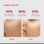 Thumbnail for Proven Honest Derma (PHD) 10% Niacinamide Spot Correcting Serum - Distacart