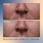 Thumbnail for Farmacy Beauty Honey Glow 17% Resurfacing Acid Serum