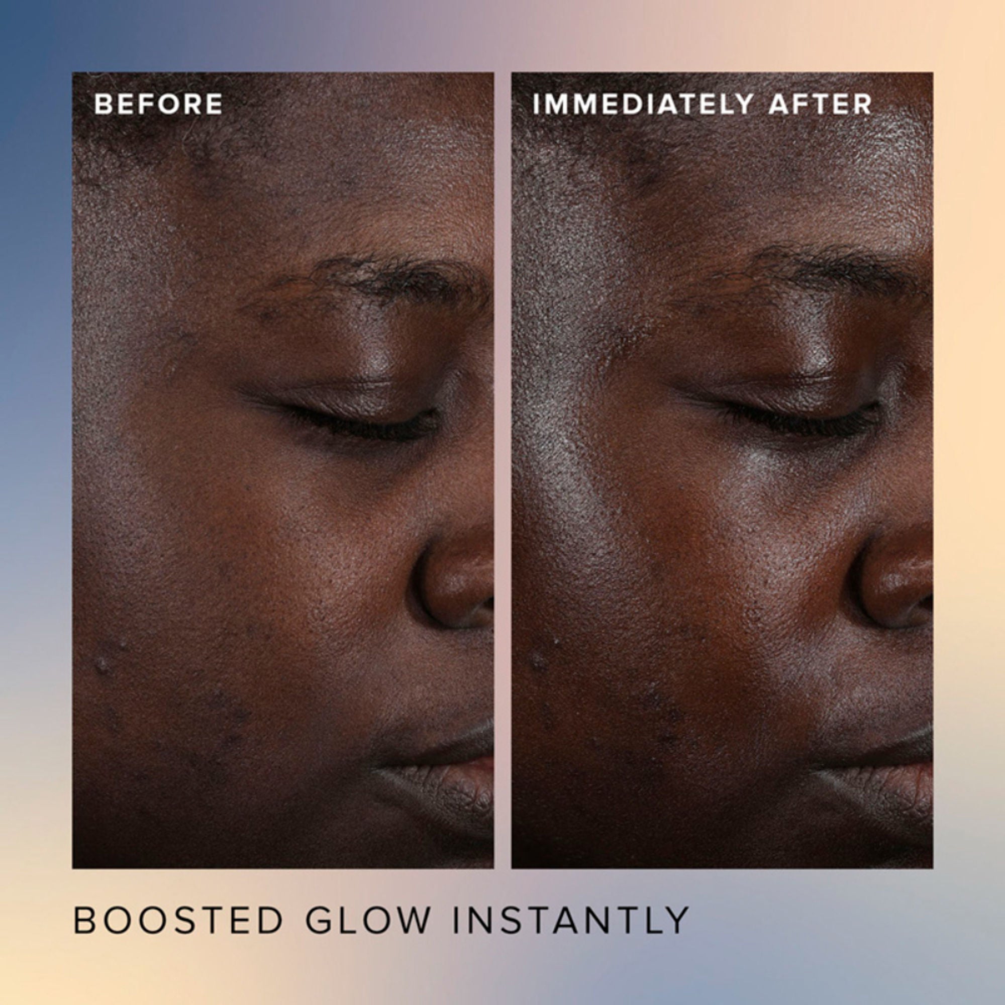 Farmacy Beauty Honey Glow 17% Resurfacing Acid Serum