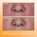 Thumbnail for Farmacy Beauty Honey Milk Hydrating Essence