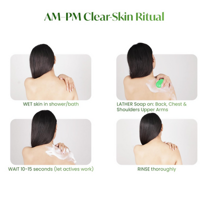 Alite Neem & Aloe Vera Soap for Gentle Daily Cleansing - Distacart
