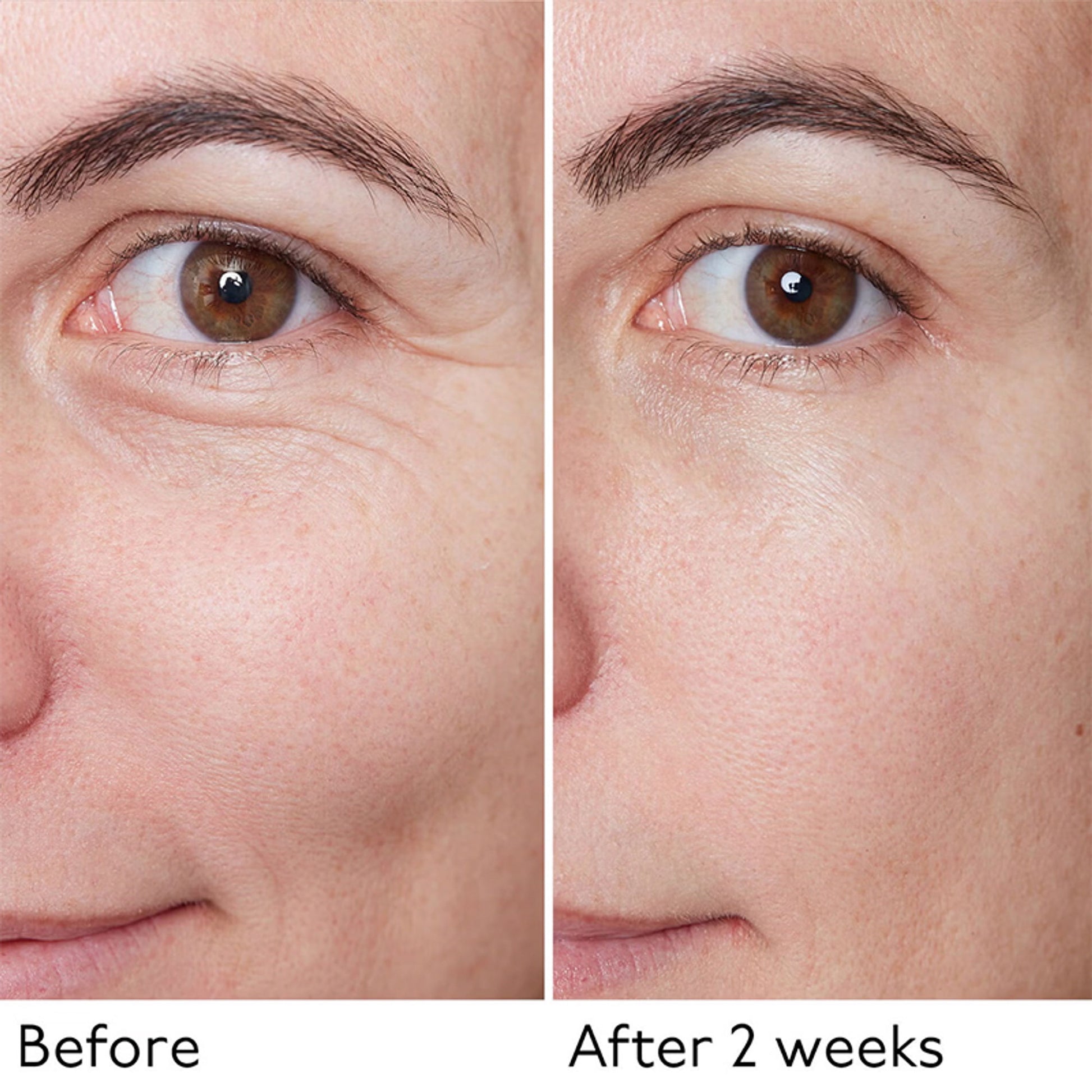 By Terry Hyaluronic Global Serum - Distacart