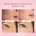 Thumbnail for Renee Cosmetics Pink Therapy PDRN Pink Peptide Serum For Radiant Skin, Hydrating, Hyaluronic Acid Infused