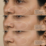 Thumbnail for VedicDerm Advanced Bakuchiol Night Repair Cream - Distacart