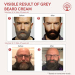 Thumbnail for Ivory Natural Greys Beard Cream Restores Your Beard's Natural Color - Distacart