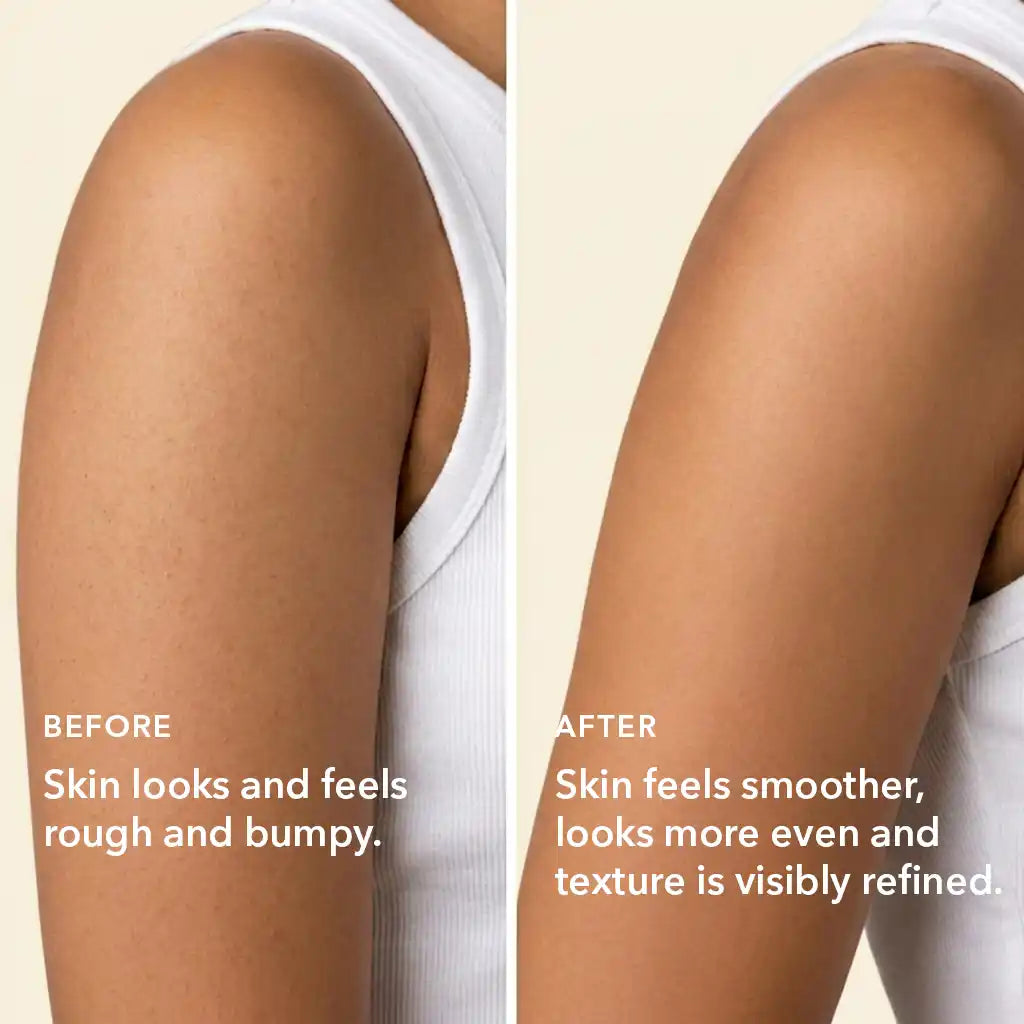 Boofootel SOOPERSMOOTH Body Serum - Dista