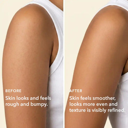 Boofootel SOOPERSMOOTH Body Serum - Dista