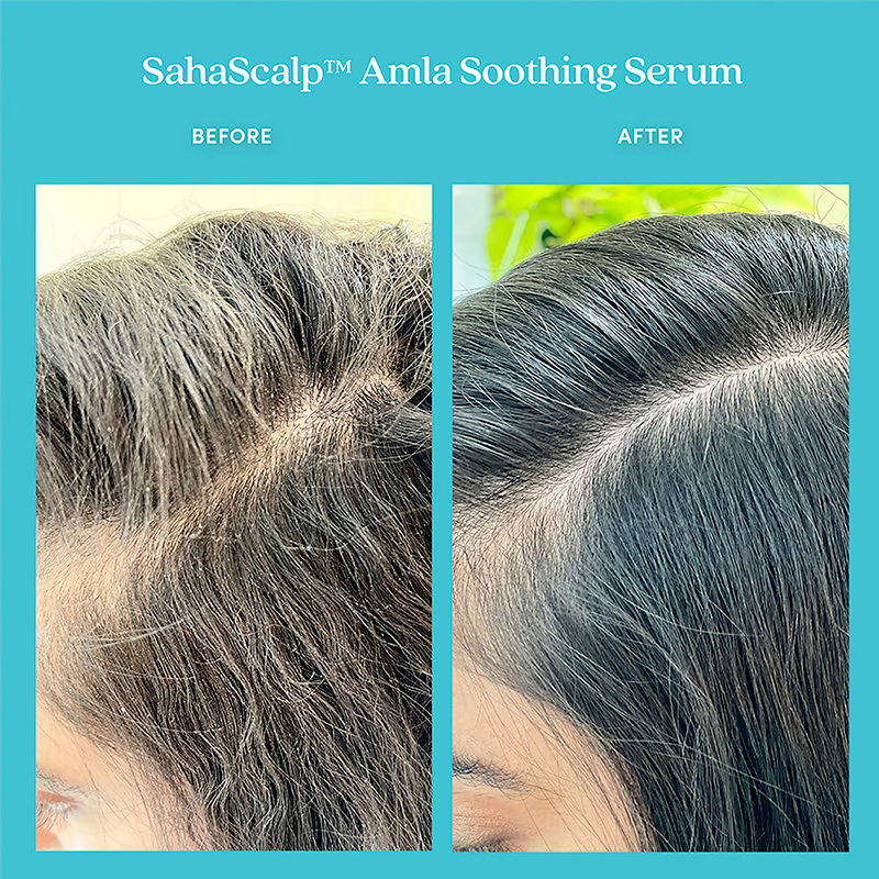 Fable & Mane Sahascalp Amla Soothing Hair Serum For Dry And Sensitive Scalp - Distacart
