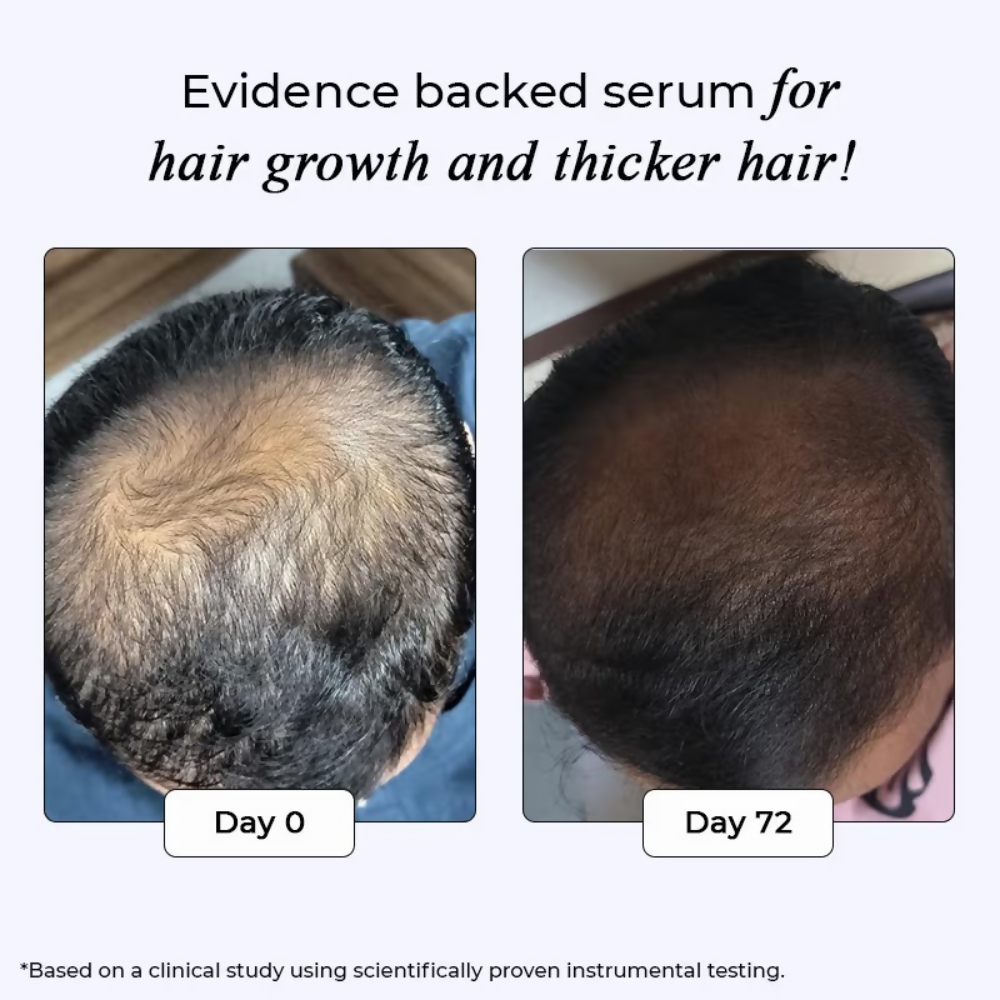 Dr. Su Revive Hair Growth Serum Hairfall Control - Dista
