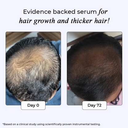 Dr. Su Revive Hair Growth Serum Hairfall Control - Dista