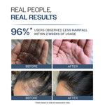 Thumbnail for Bare Anatomy Anti-Hair Fall Shampoo 5X Hair Fall Control With Peptides - Dista
