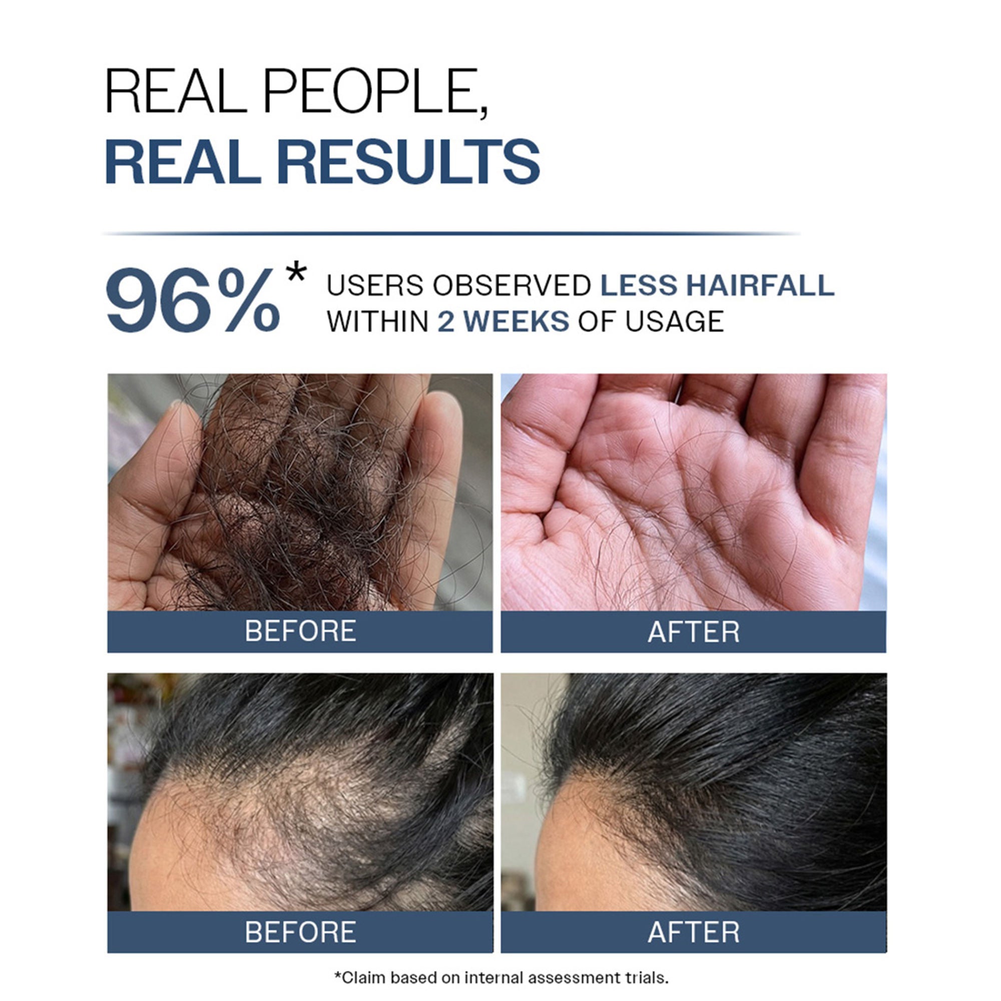 Bare Anatomy Anti-Hair Fall Shampoo 5X Hair Fall Control With Peptides - Dista