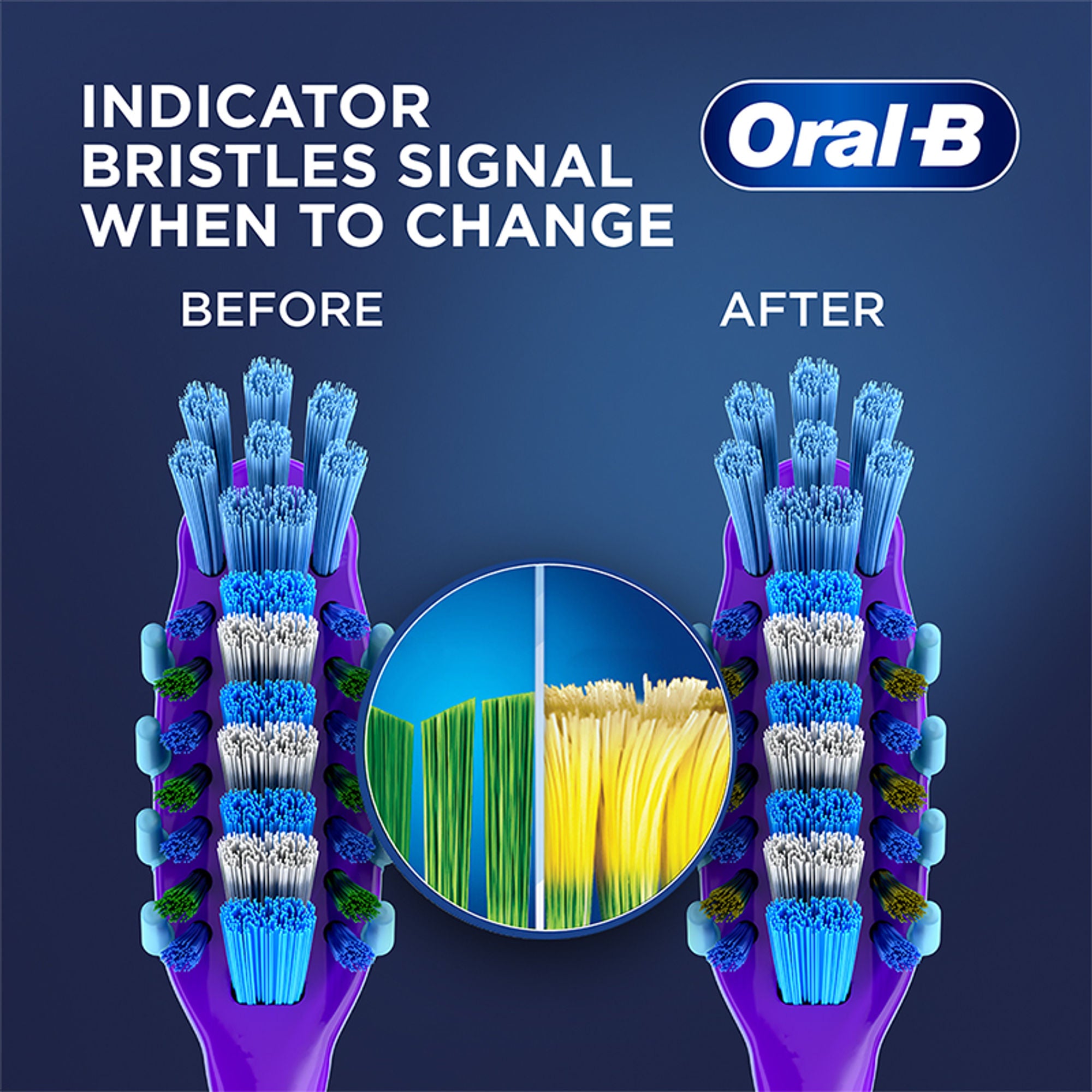 Oral-B Criss Cross Gum Care Toothbrush Buy 2 Get 2 Free (Soft) - Distacart