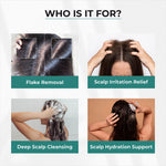 Thumbnail for Dr.Sakhiya Anti-Dandruff Shampoo, Itchy Scalp Relief For Men & Women - Distacart