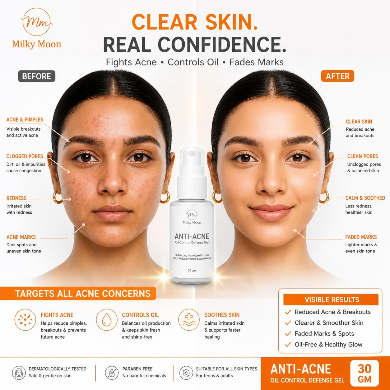 Milky Moon Rapid Relief Anti-Acne Gel - Dista