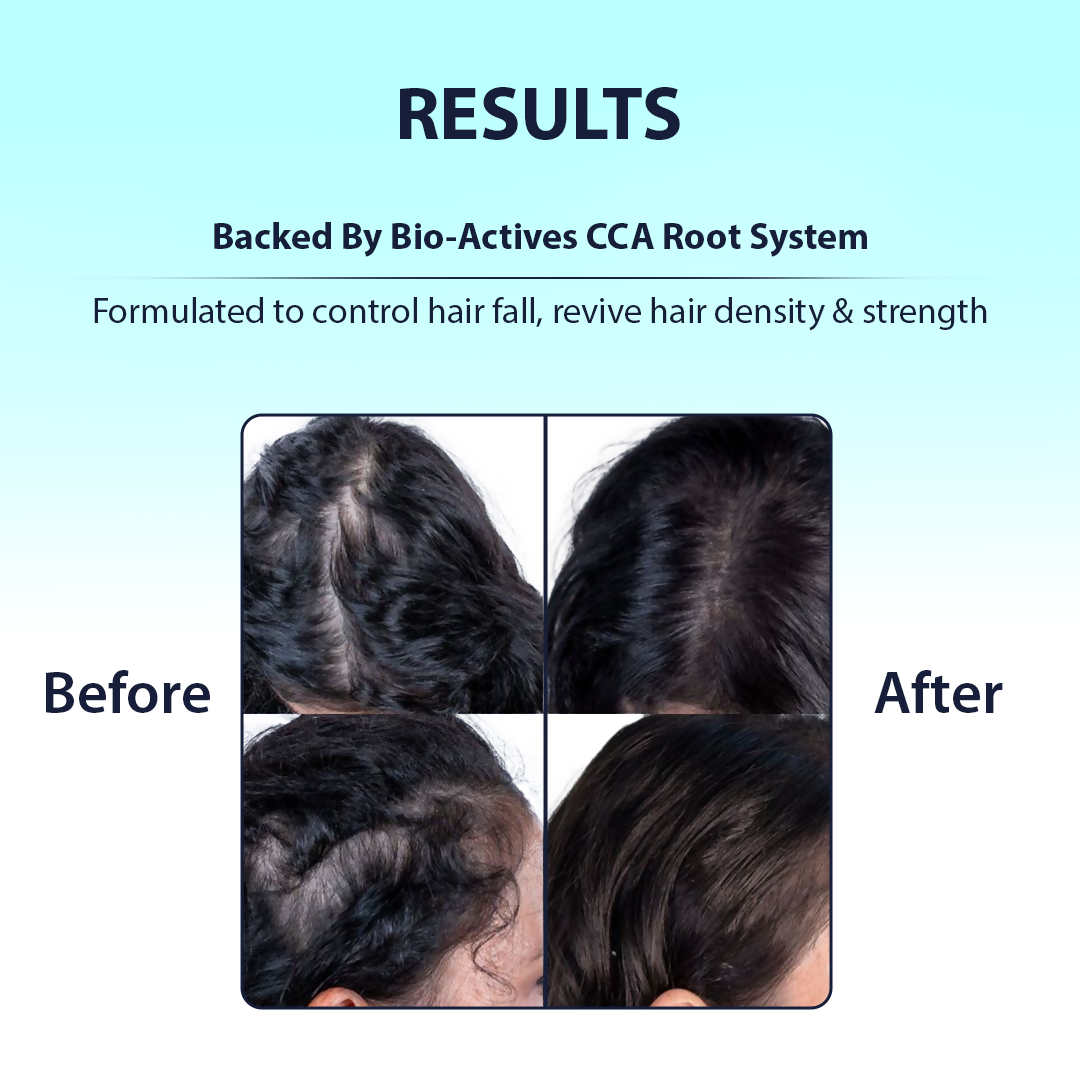 Dermistry Caffeine Collagen Protein Anti-Hair Fall Control Mask - Distacart
