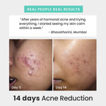 Thumbnail for The Solved Skin Rapid Clear Face Wash - Dista