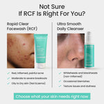 Thumbnail for The Solved Skin Rapid Clear Face Wash - Dista