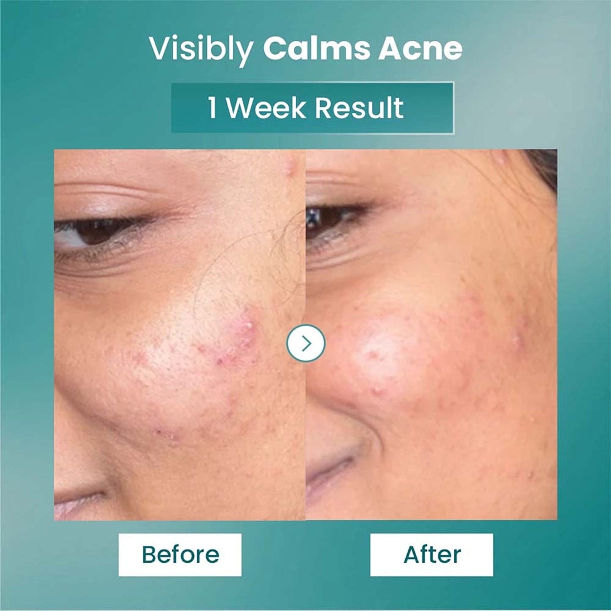 The Solved Skin Spot Fade Advance Repair Serum - Dista