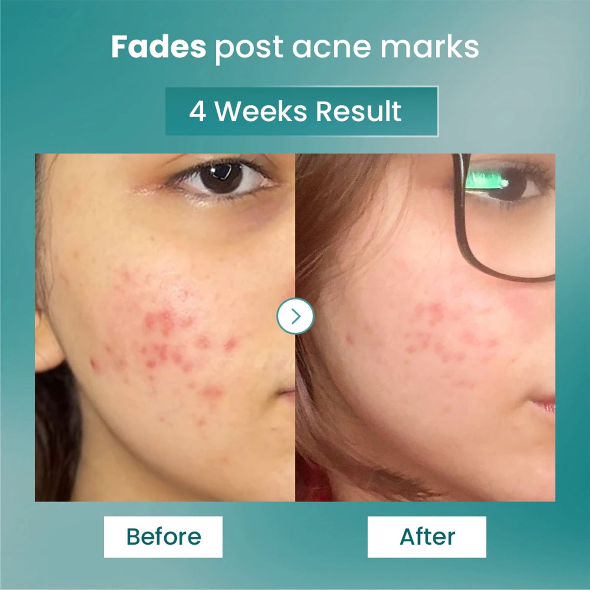 The Solved Skin Spot Fade Advance Repair Serum - Dista