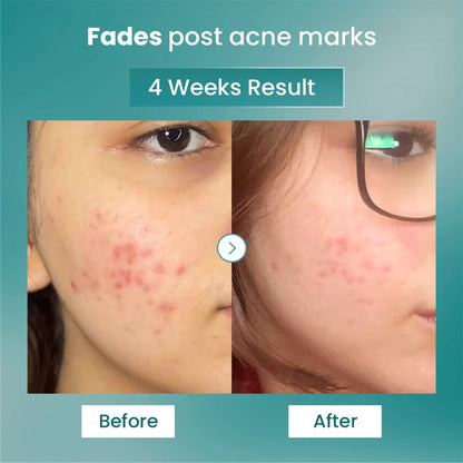 The Solved Skin Spot Fade Advance Repair Serum - Dista