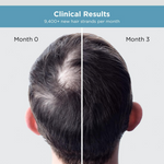 Thumbnail for The Man Company Hair Growth Serum For Man