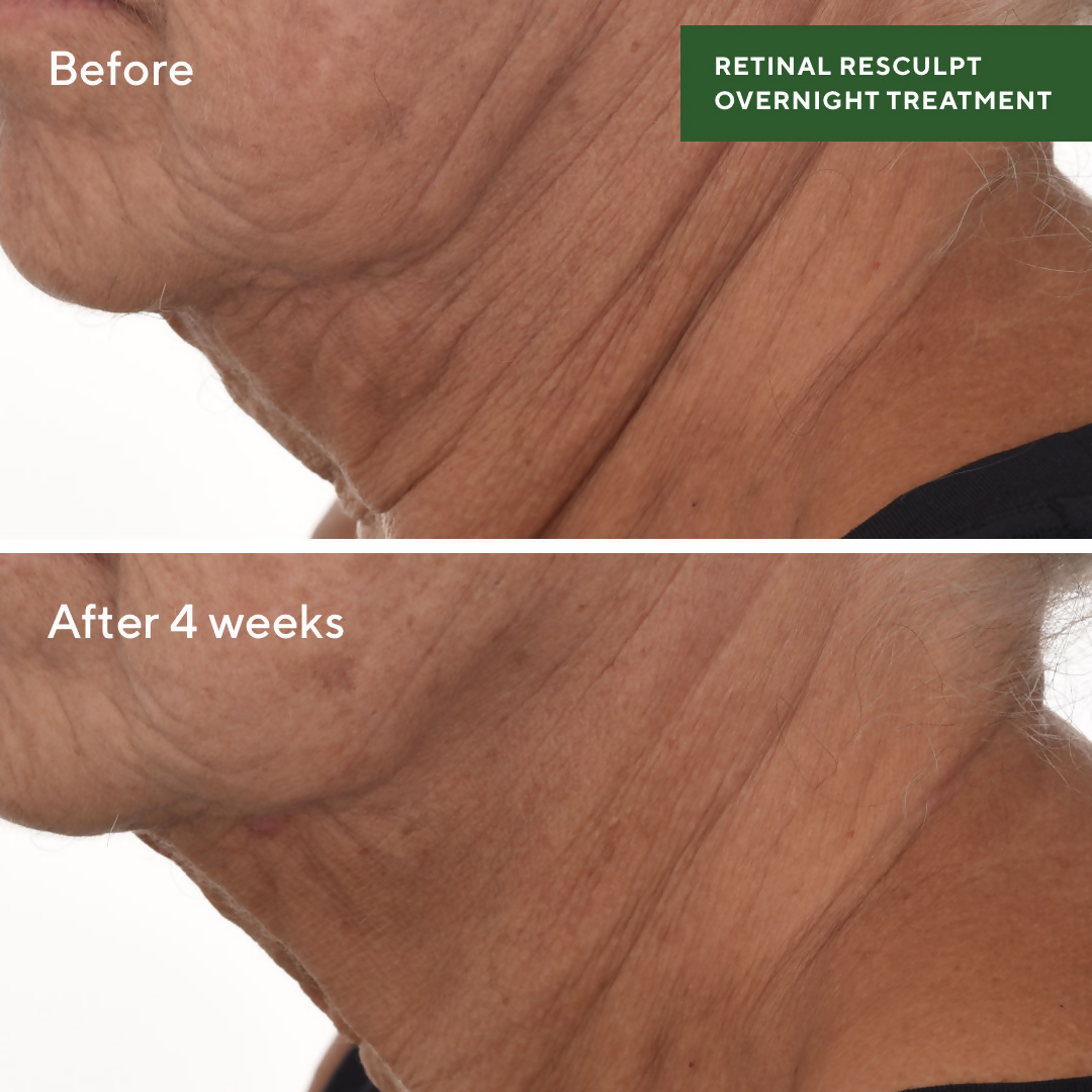 Murad Retinal ReSculpt Overnight Treatment - Distacart