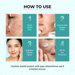 Thumbnail for Dr.Sakhiya Acne & Pimple Care Kit - Distacart