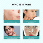 Thumbnail for Dr.Sakhiya Acne & Pimple Face Wash - Distacart