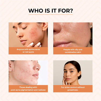 Dr.Sakhiya Acne & Pimple Morning Cream - Distacart